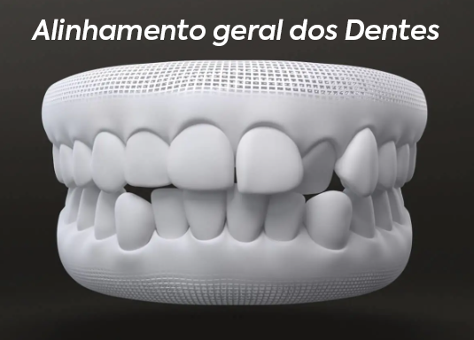 Alinhamento-geral-dos-dentes.png