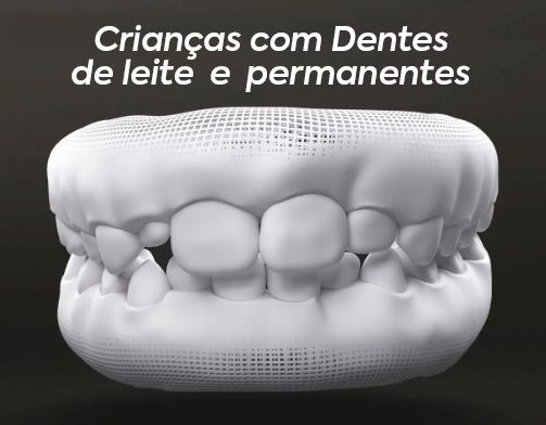 Criancas-com-dentes-de-leite-e-permanentes.png